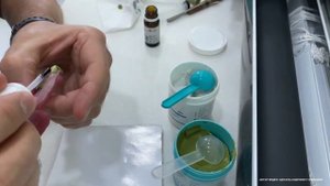 Оформление краев индивидуальной ложки для функционального оттиска при полном съемном протезировании