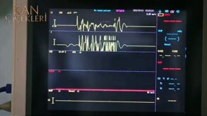 кровавые цветы турецкий сериал клип