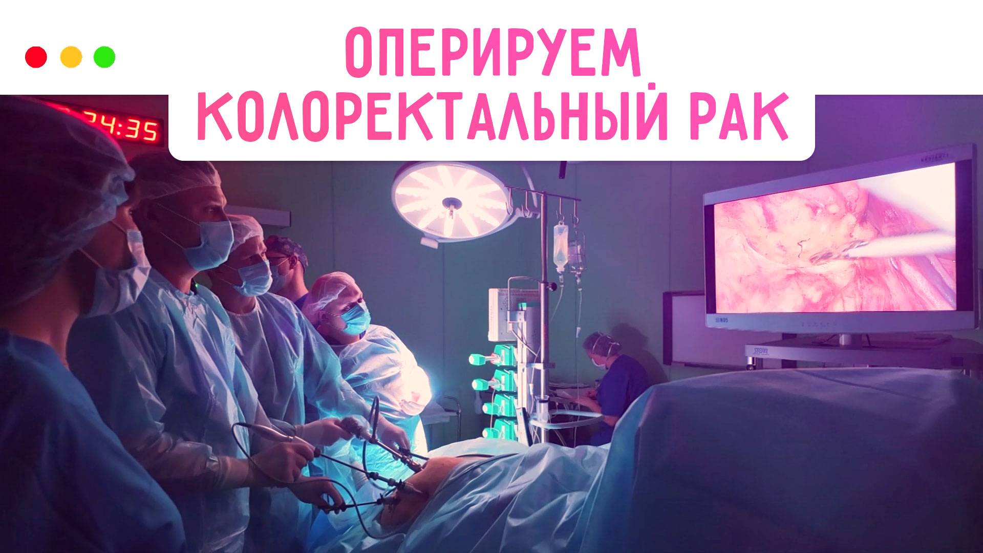 Как не пропустить рак кишечника? МЕДСОВЕТ