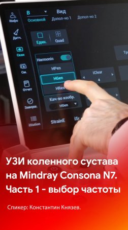 УЗИ коленного сустава на Mindray Consona N7. Часть 1 - выбор частоты сканирования