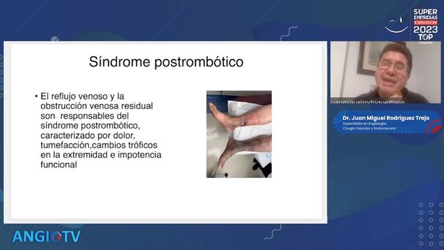 "CIRUGÍA Y MEDICACIÓN ANTITROMBÓTICA". | ANGIO TV | E10, T2. смотреть онлайн