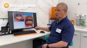 Рецессия десен: варианты лечения