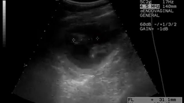 Наш малыш (узи) смотреть онлайн