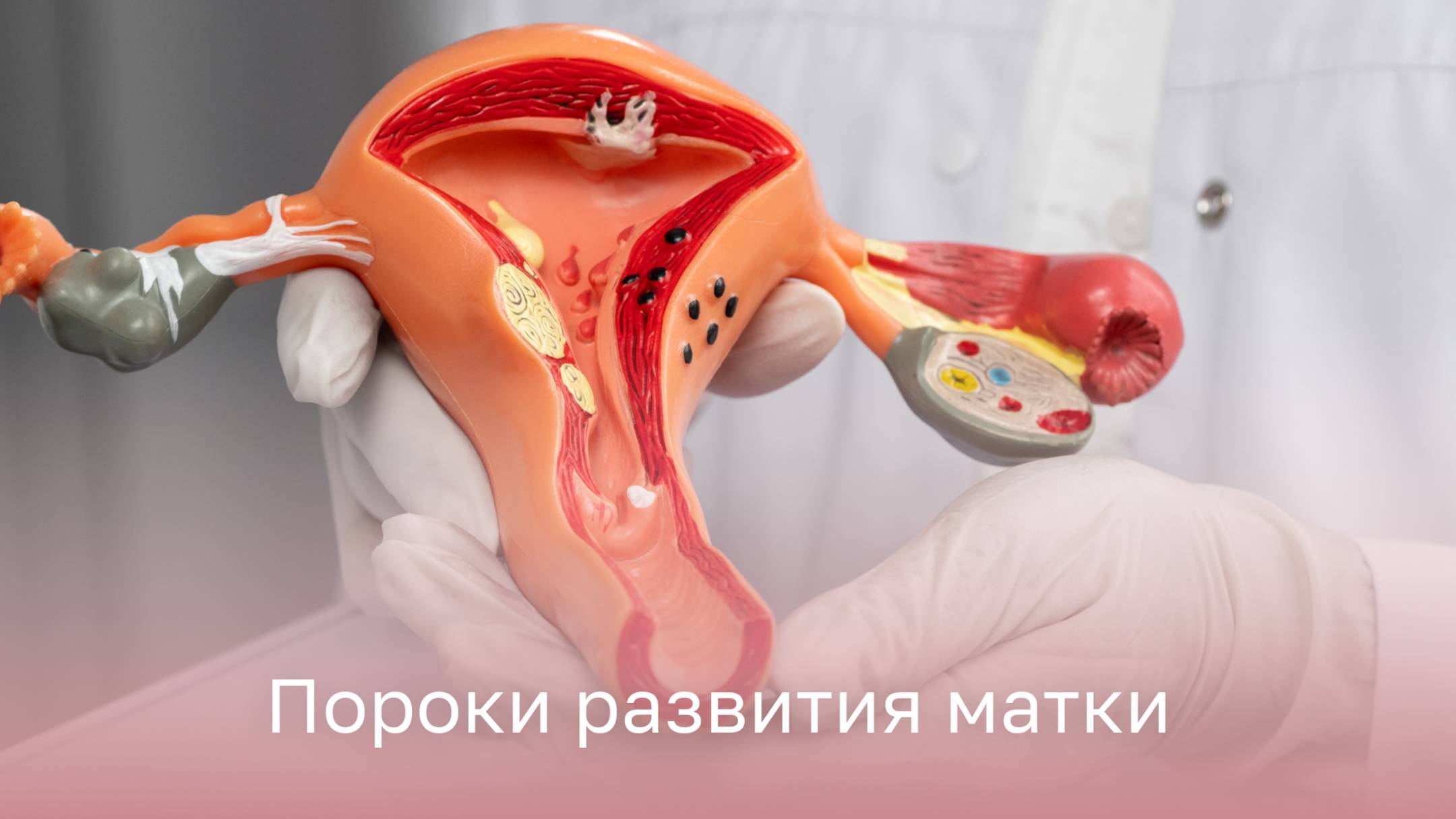 👩⚕️ Психосоматика и пороки развития матки