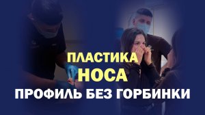 Первые эмоции после ринопластики: реакция перед зеркалом