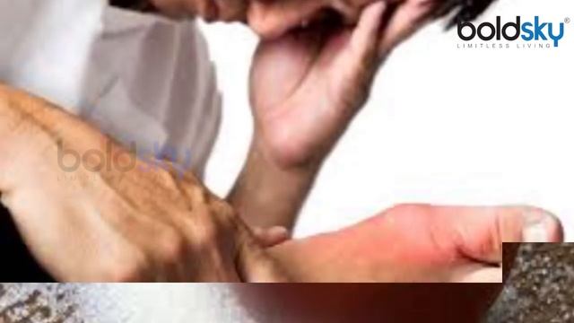 कनखजूरे के काटने पे घबराए नहीं, तुरंत करें ये घरेलु उपाय, Centipede Bite -Home Remedies | Boldsky смотреть онлайн