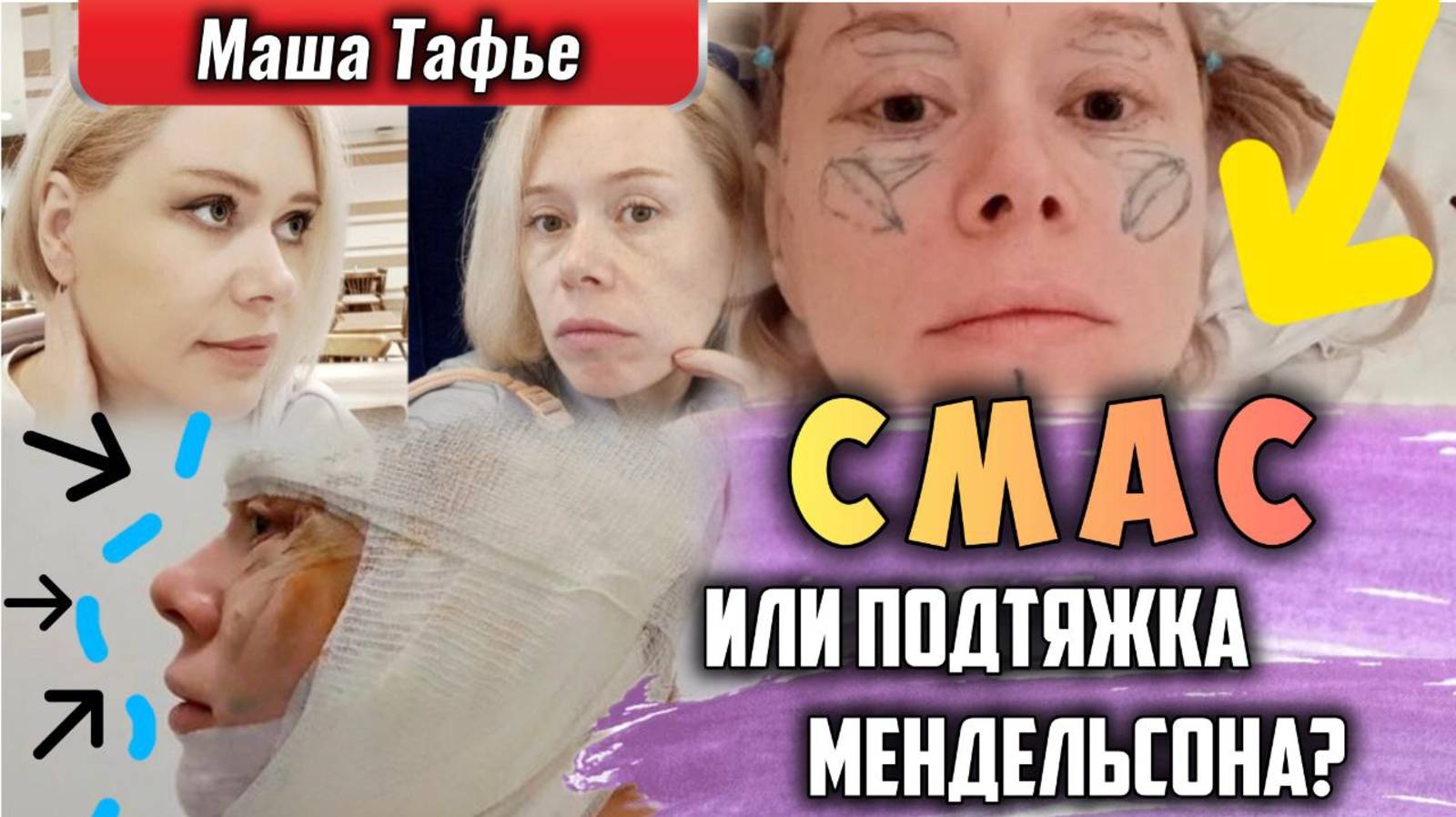 Натянуть, чтоб держалось! Смас или подтяжка Мендельсона? Зима с Машей ❄️ Видео №80