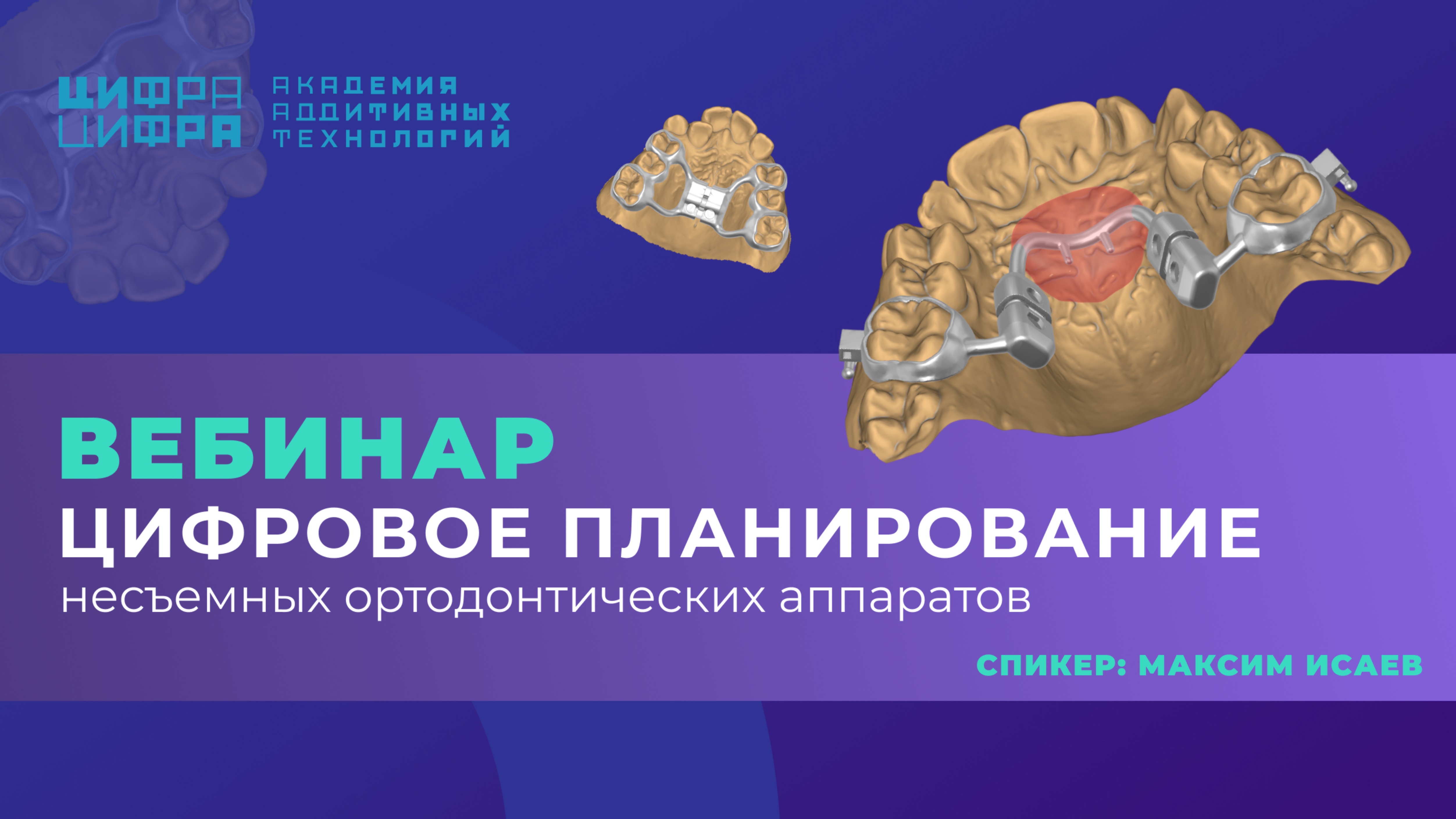 Цифровое планирование несъемных ортодонтических аппаратов | Академия Цифра Цифра, Максим Исаев