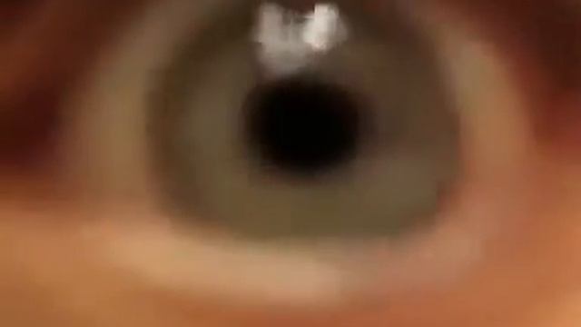 Видишь мой глаз????