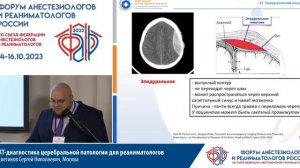 КТ мозга для ИТ Светиков СН Съезд ФАРР 2023