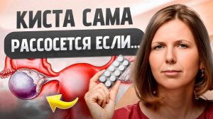 Можно ли вылечить кисту яичника БЕЗ операции? Что провоцирует кисты?