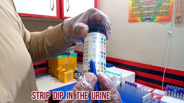 urine ketone Bodies Test Procedure | ketones in urine symptoms | Ketone Bodies Diabetes | Ketones