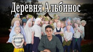 Секретная Деревня Альбиносов в Танзании (Слишком Белые, Чтобы Жить)