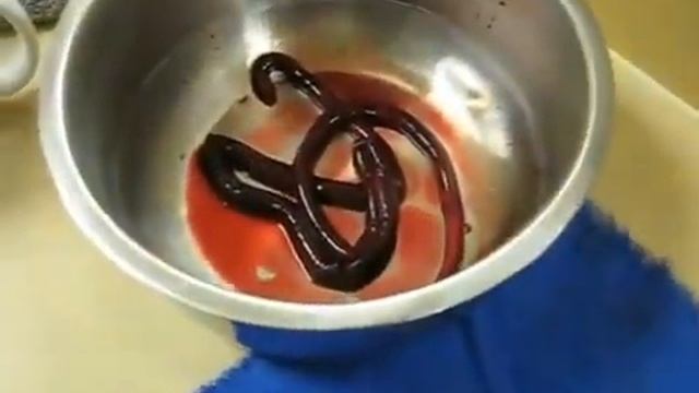 Dioctophyma renale- verme gigante do rim смотреть онлайн