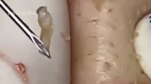 𝐂𝐡𝐢𝐥𝐥 𝐘𝐨𝐮𝐫 𝐋𝐢𝐟𝐞 𝐖𝐢𝐭𝐡 𝐋𝐍𝐆 𝐒𝐤𝐢𝐧 𝐂𝐚𝐫𝐞 #168