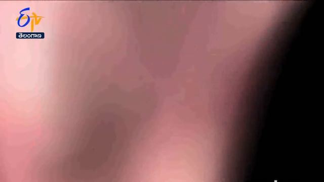 How Diabetes Effect Sexual Life?  Sukhibhava  23rd January 2023  ETV TS