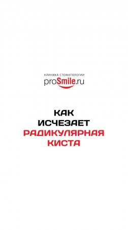 Исчезла радикулярная киста