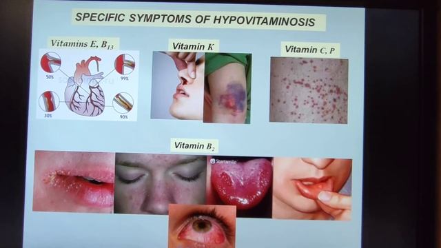 Vitamins theory смотреть онлайн