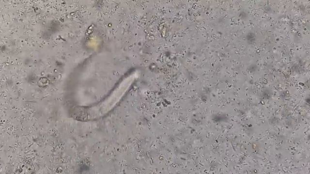 Strongyloides stercoralis смотреть онлайн