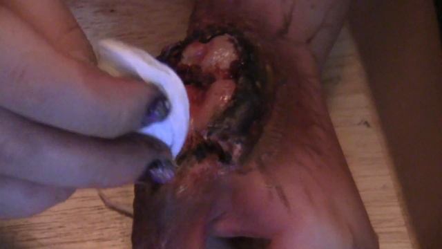 Spider Bite Gone Wrong смотреть онлайн