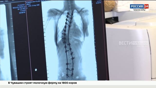 Чувашские врачи подарили девушке из Бердянского округа новую жизнь