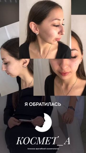 Многочисленные попытки вылечить акне оказались безрезультатными?