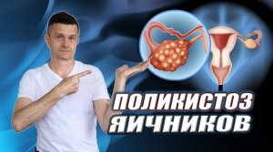 ПОЛИКИСТОЗ ЯИЧНИКОВ | Лечение в аюрведе