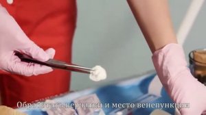 Техника постановки периферического венозного катетера