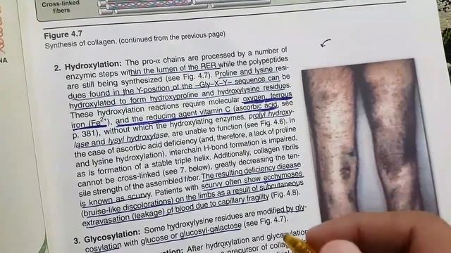 lippincott chapter 4 (fibrous proteins)|part 2 of 3| synthesis, degradation and diseases of collage смотреть онлайн