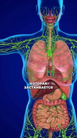 Как БЫСТРО снять отеки РАЗ И НАВСЕГДА? #здоровье #отеки #питание