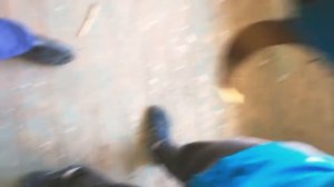 У школьника взорвался мех мод