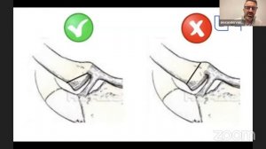 SternoClavicular Joint Pathology