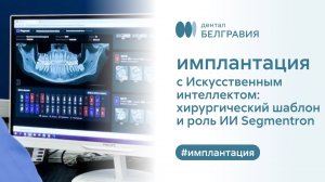 🦷 Имплантация с Искусственным интеллектом: хирургический шаблон и роль ИИ Segmentron