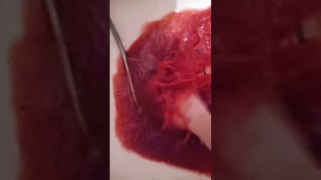 момо ранили. ее кровь. #момо #momo смотреть онлайн