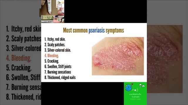 ยาทาแก้คัน จีน смотреть онлайн