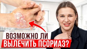 Проверь симптомы псориаза у себя! / Причины появления болезни