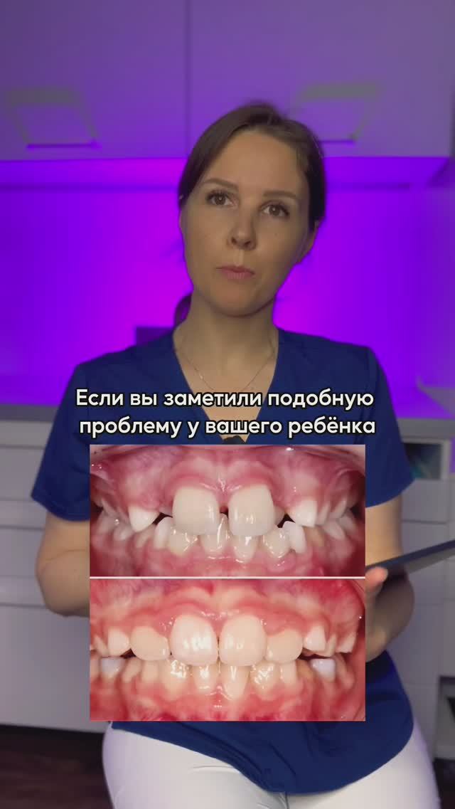 У ребёнка растут зубы в два ряда Как исправить❓