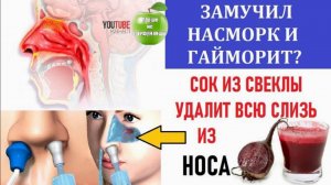 Замучил насморк и гайморит? Сок из свеклы удалит всю слизь из носа