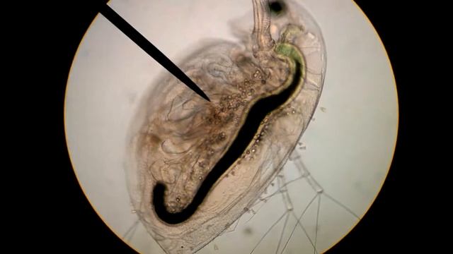 Arthropoda Crustacea Daphnia in Dr. Tim Forrest's Zoology Lab смотреть онлайн