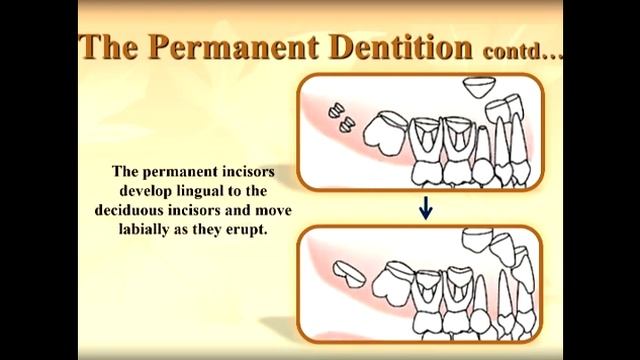 محاضرة تقويم الاسنانTransition of incisors للأستاذ الدكتور وسام وهاب المرحلة الخامسة смотреть онлайн