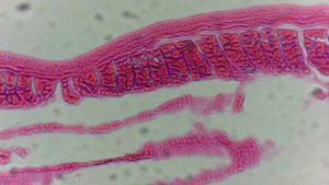 Срез дождевого червя Cut of an eartworm