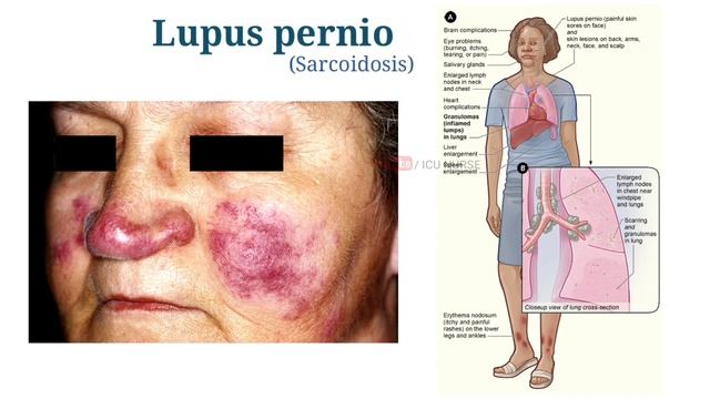 2020 Staff Nurse model paper Regular MCQs practice смотреть онлайн