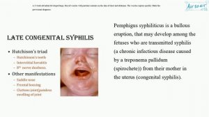 [ Krok 2 Medicine ] Year: 2019 - 111 (Ministry of Public Health of Ukraine)