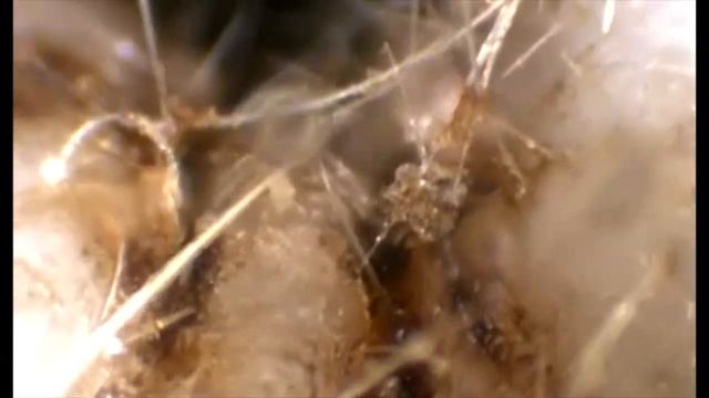 Sanfield: Video Otoscopia en Otitis Felina por Otodectes Cynotis. смотреть онлайн