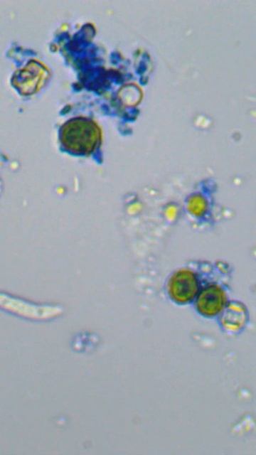 Amoeba 🔬 speed X 8 #Shorts смотреть онлайн