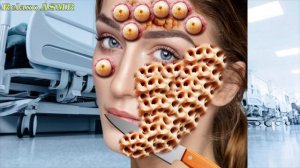 ASMR ANIMATION 😲😒 | REMOVE TRYPOPHOBIA, DOG TICKS FROM INFECTED FACE | ASMR TREATMENT