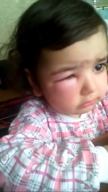 Укус пчелы смотреть онлайн