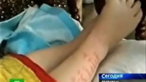 Miracles of Islam, Verses of Holy Quran Appeared on Skin of baby