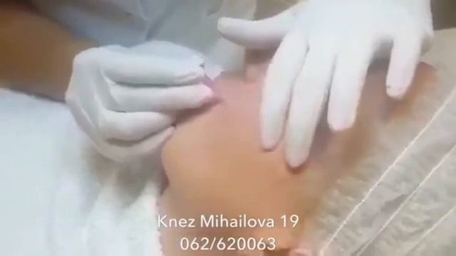 Mezo niti - Dr Jelena Glavinic смотреть онлайн