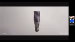 Николай Лысенко "Кратко о системе Neodent Helix GM"